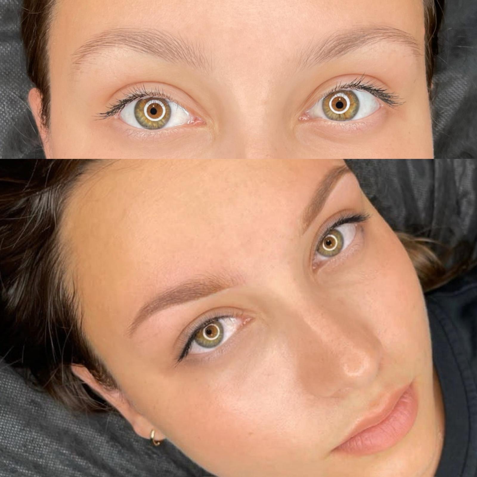 Brows before/after