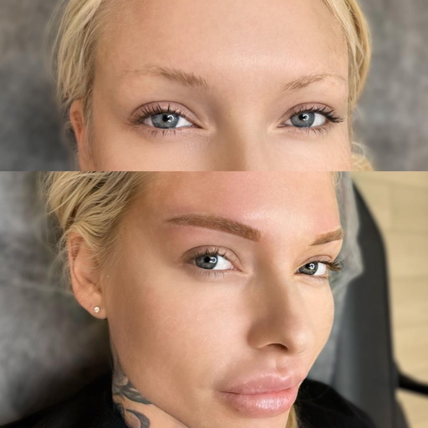 Brows before/after