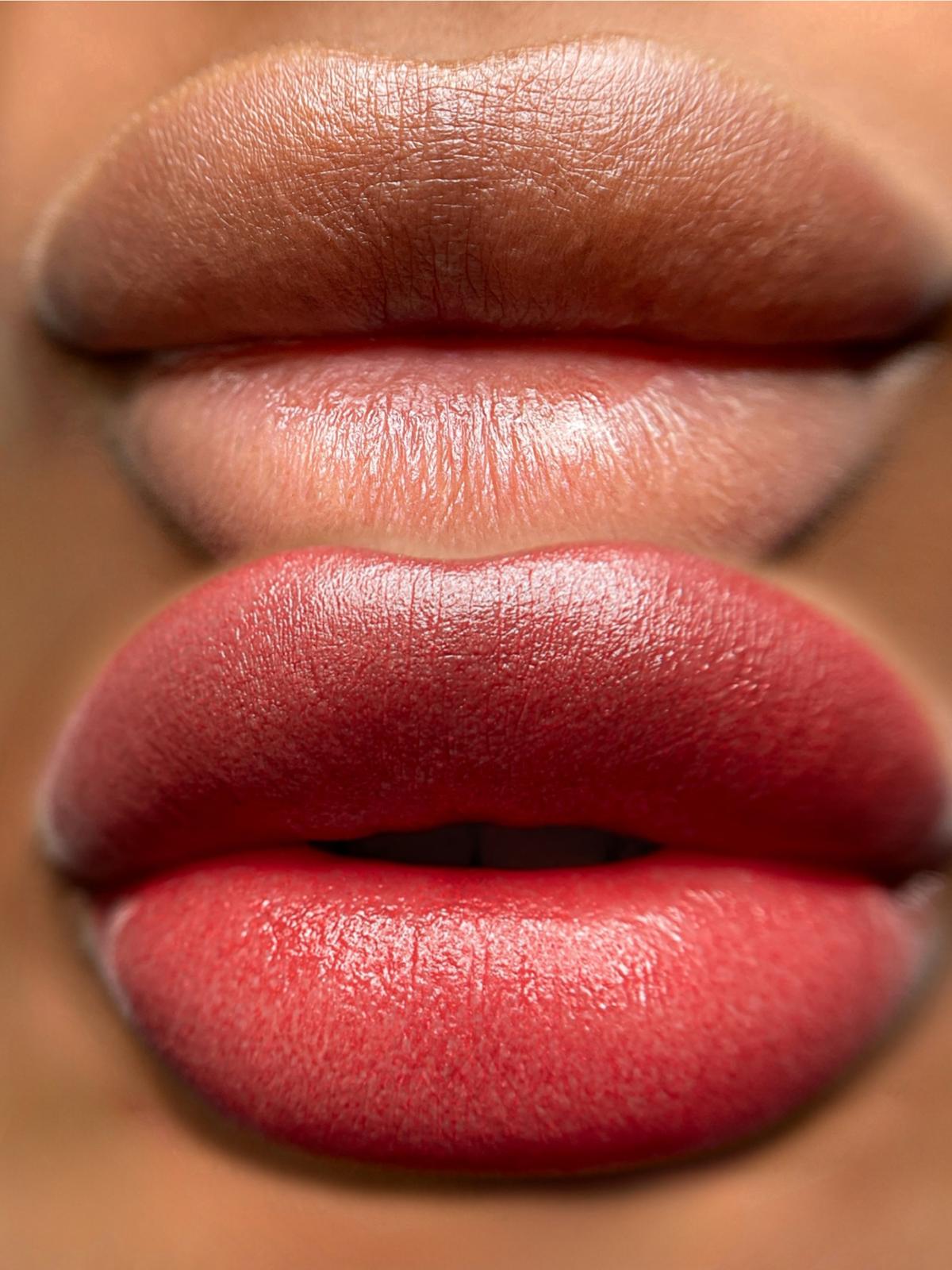 Dark lips before/after