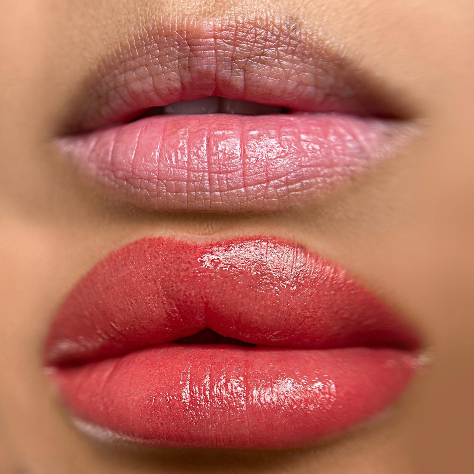 Dark lips before/after