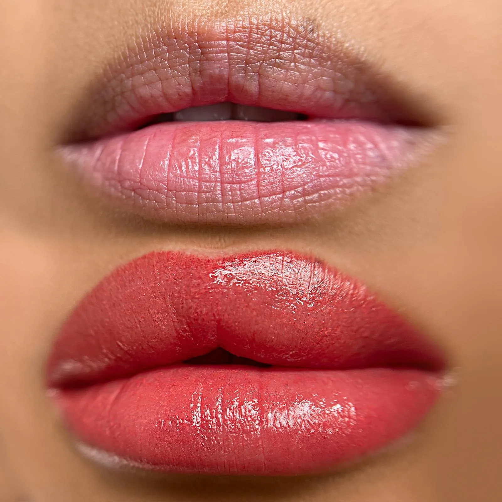 Lip Neutralization before and after
