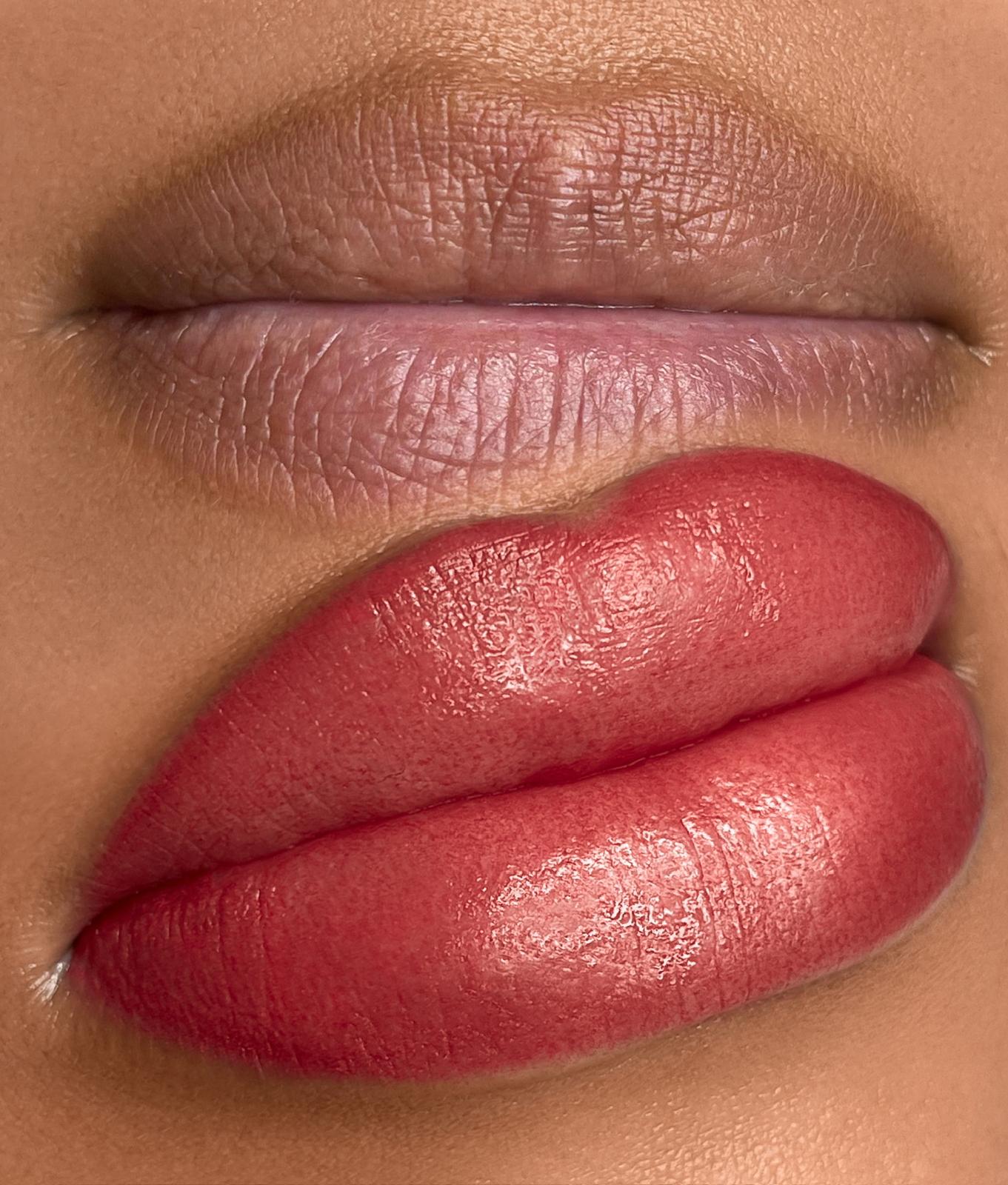 Dark lips before/after