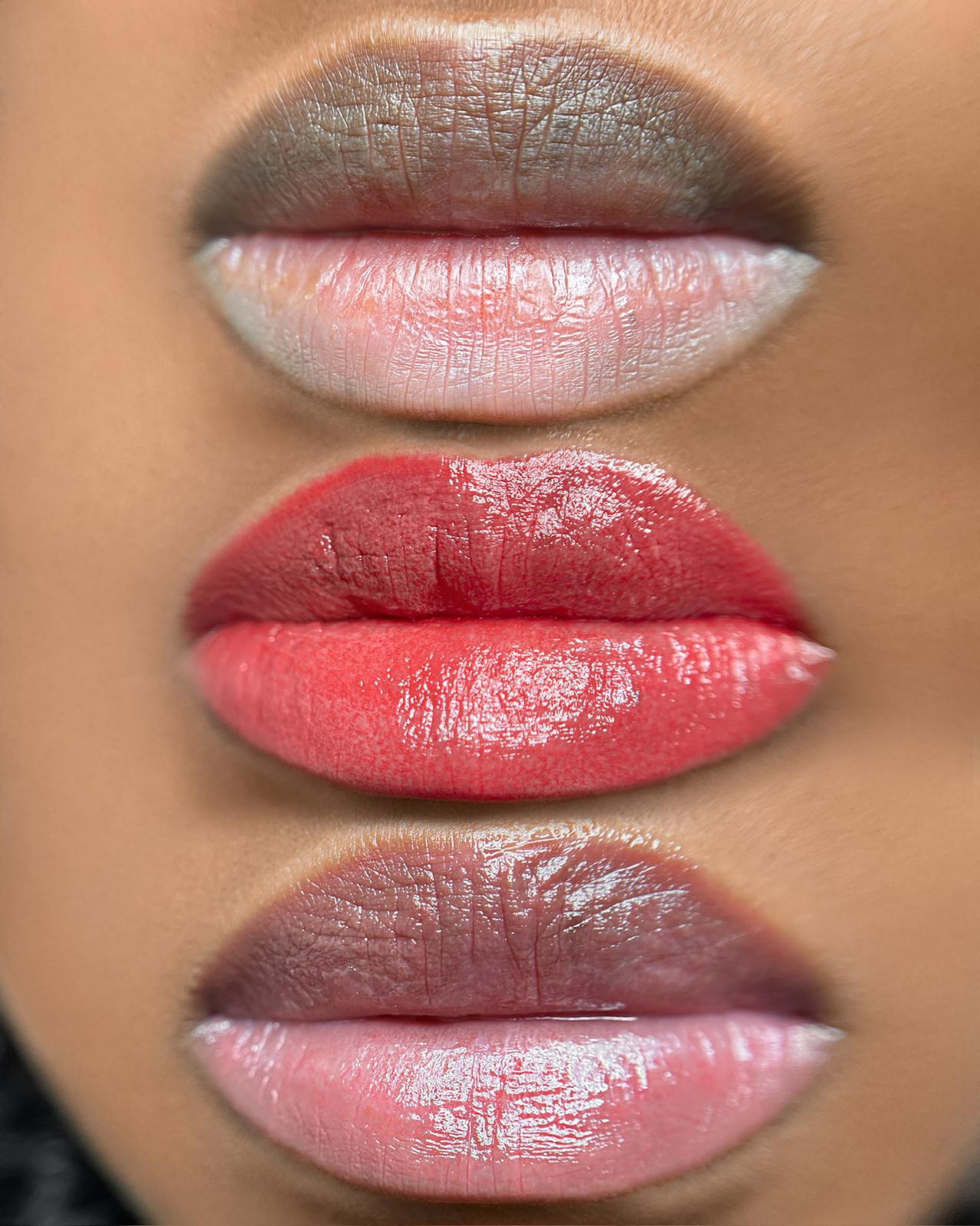 Dark lips before/after