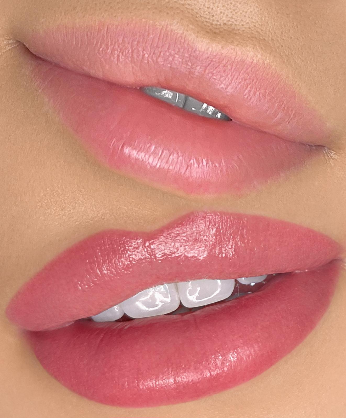 Lips before/after