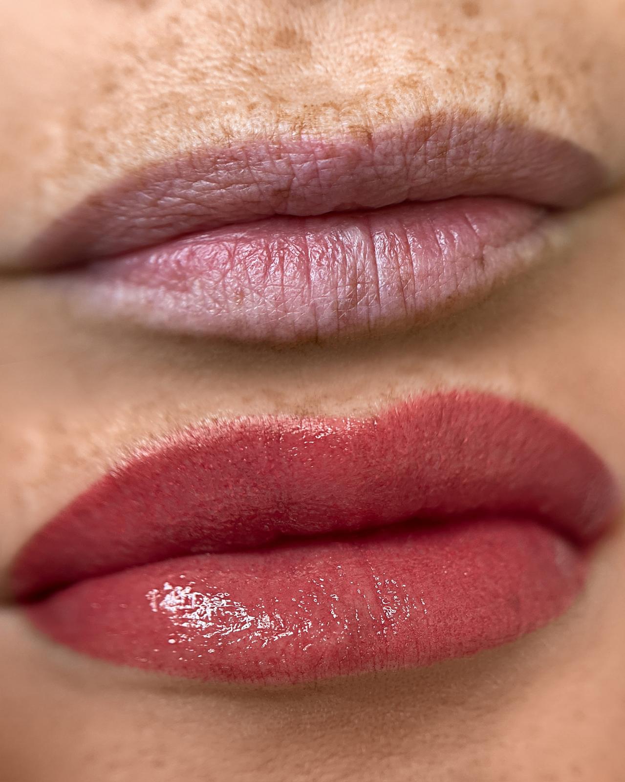 Lips before/after