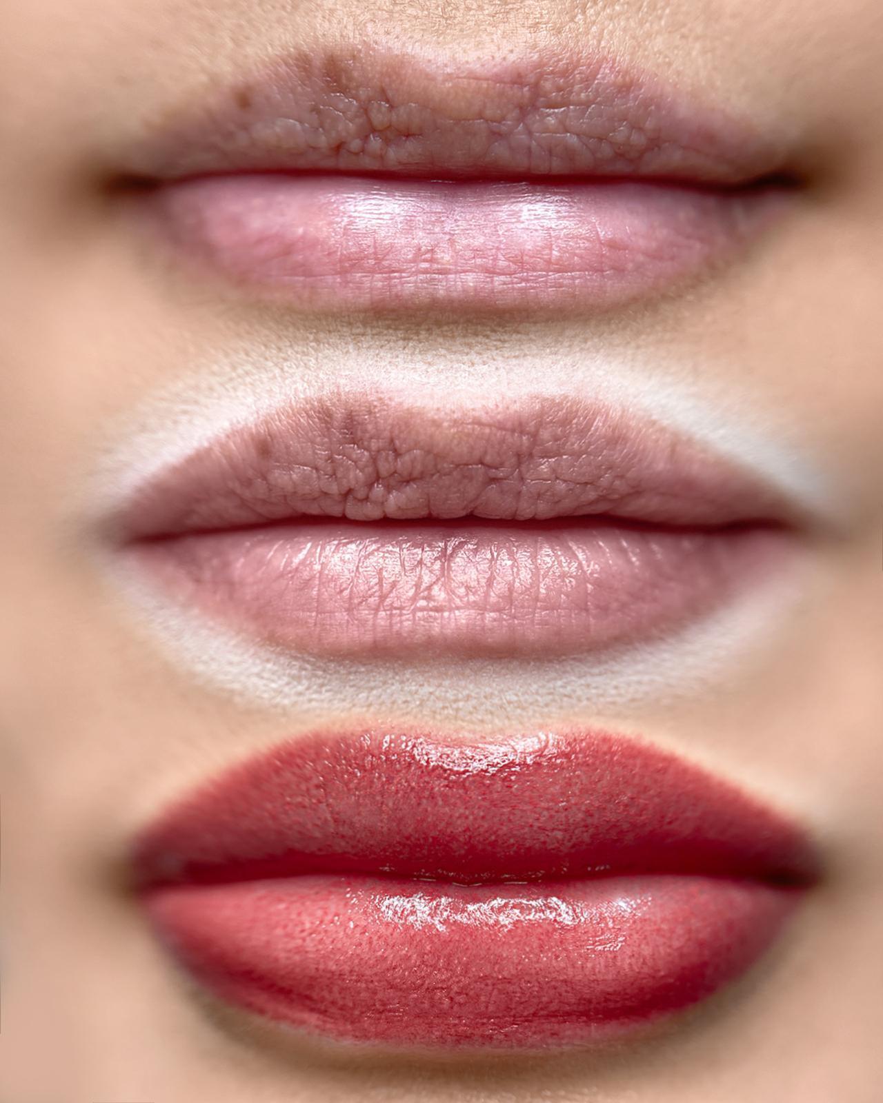 Lips before/after